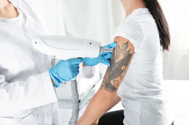 Tattoo removal service on girl’s arm
