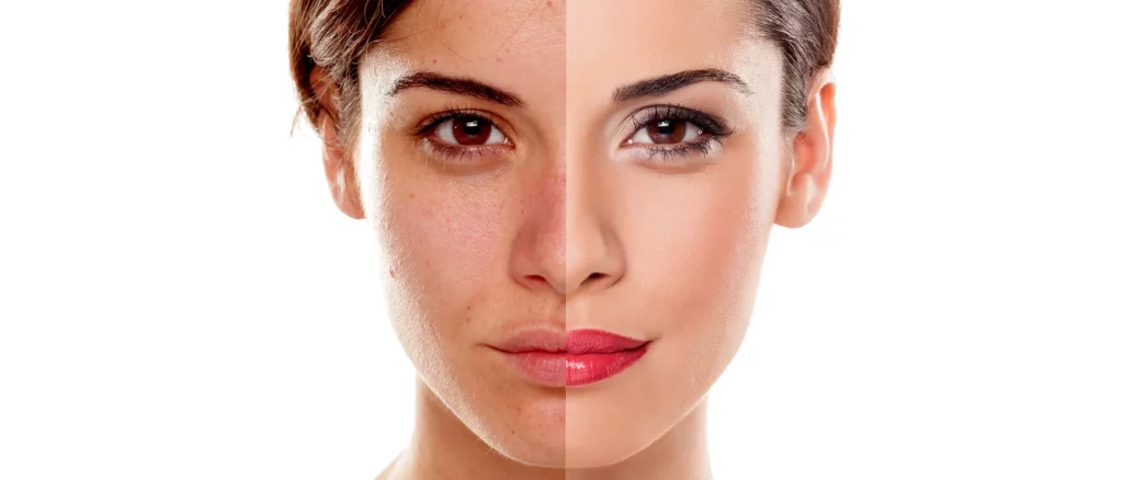 Unhealthy skin that looks dull and tired vs healthy, radiant skin.
