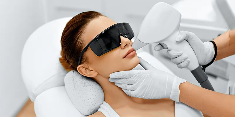 Woman getting laser treatment for facial hair.