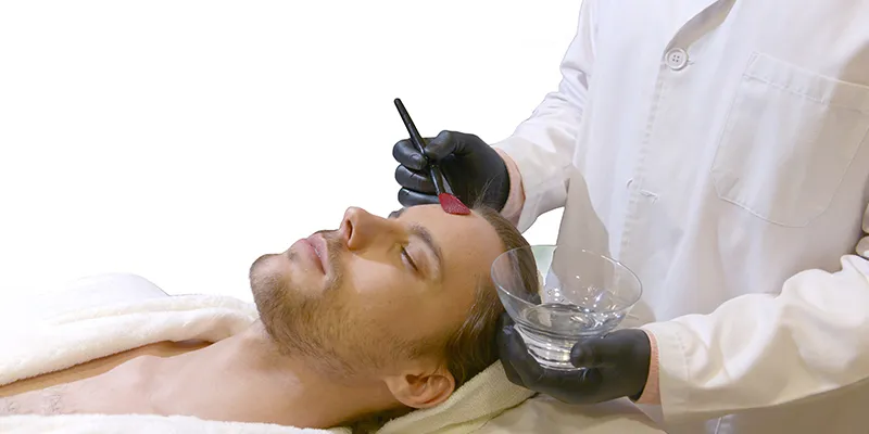 Chemical peels - face procedures to look younger.