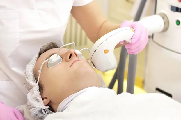 Man getting laser skin resurfacing done by a dermatologist.
