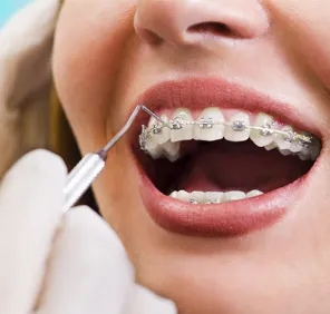 Woman getting her braces examined by a dentist at a dental care clinic.
