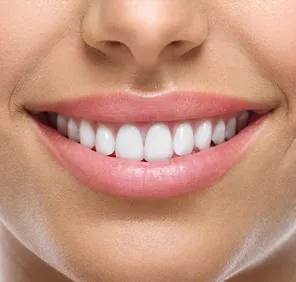 Smile designing treatment - woman with a perfect smile and symmetrical teeth.
