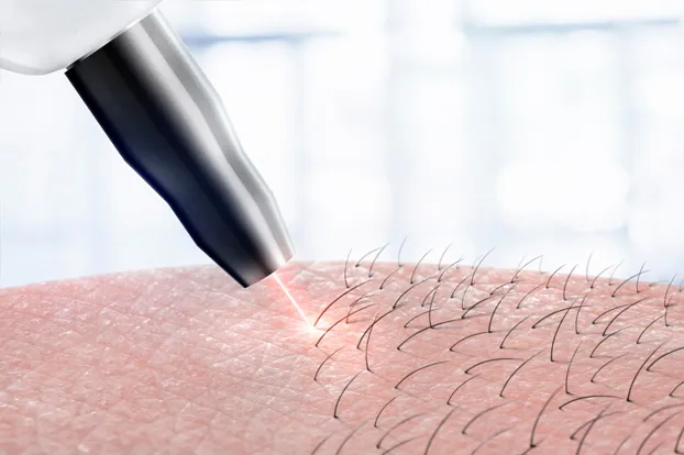 During a full body laser hair removal treatment, a clinical tool's laser light flashes.
