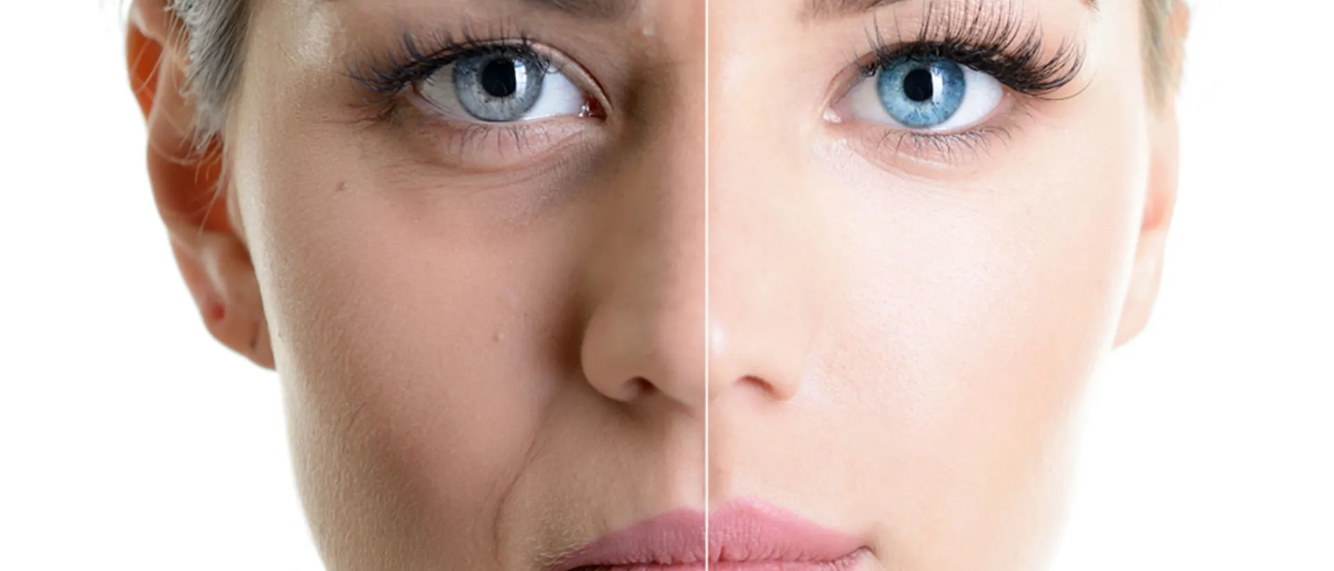 The eyeballs, eyelashes, nose, ears, and upper lip of a woman's face split into two halves to portray the benefits of anti aging treatment in Hyderabad.
