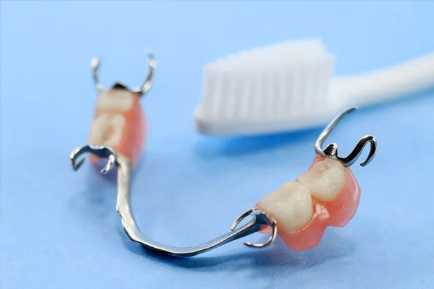 Metal wire structure of implant supported dentures with a white brush in the background.
