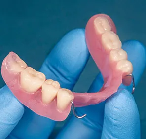 A dentist holds removable dentures in his hands. 
