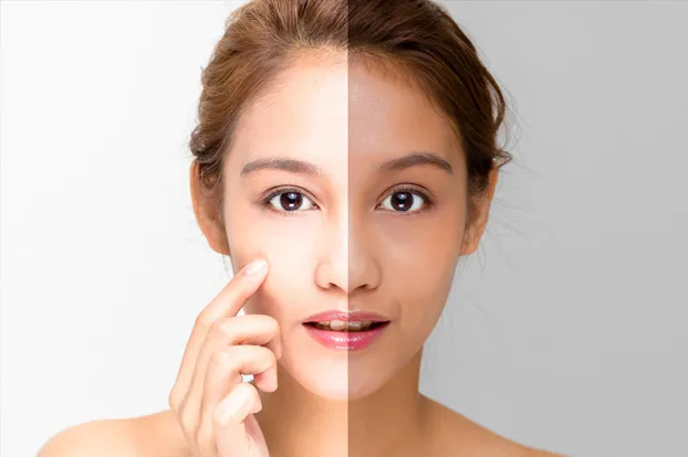 Detan in salon - woman with bright skin on one side and tanned skin on the other side of face.
