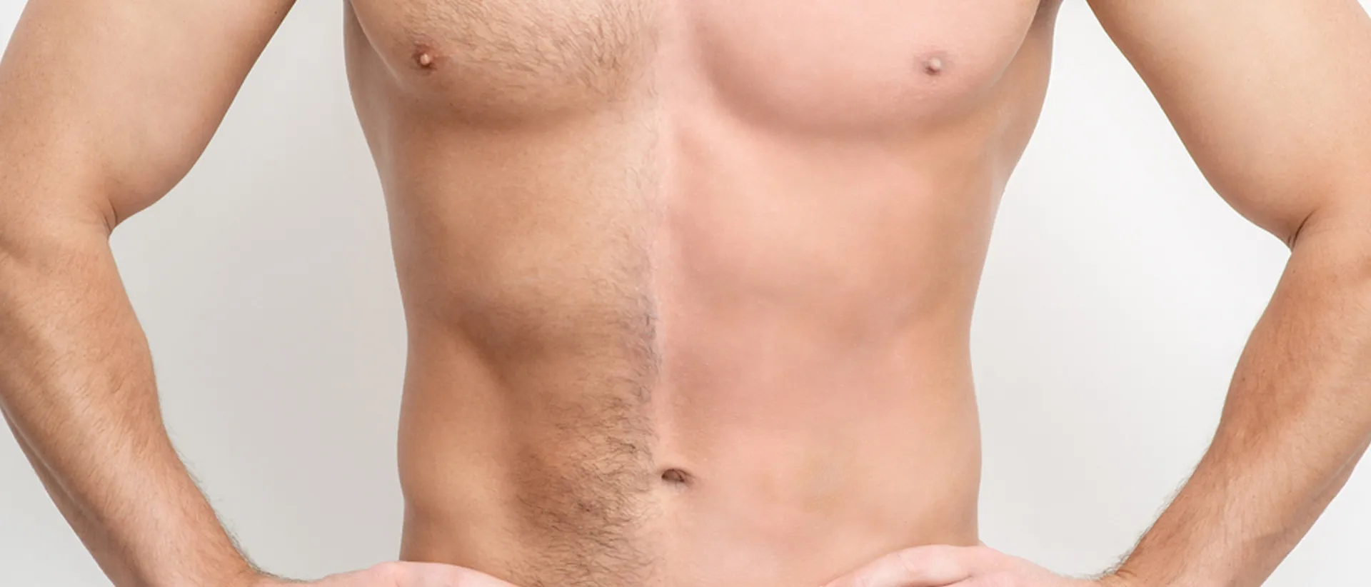 Sketching a demarcation on a man's chest to show the effectiveness of full body laser hair removal treatment