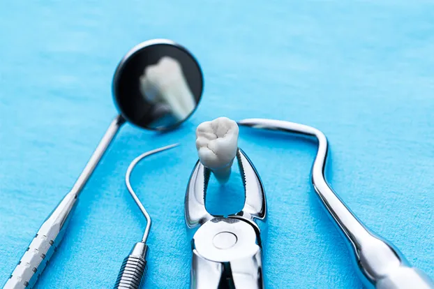 A set of dental instruments with an extracted tooth on a blue background at a dental clinic in Hyderabad.
