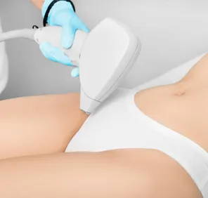 A white laser tool is pointed at the bikini line during full body laser hair removal treatment. 
