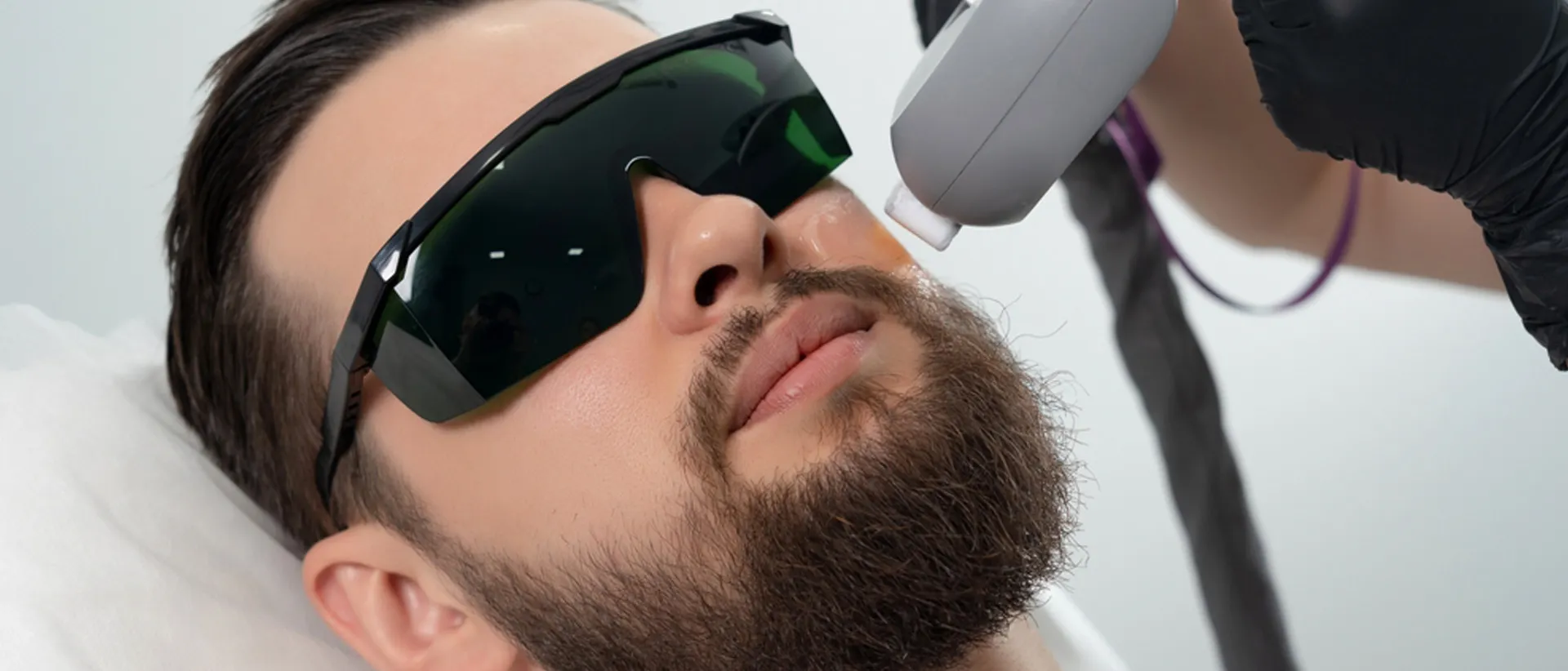 Man getting laser treatment for facial hair.
