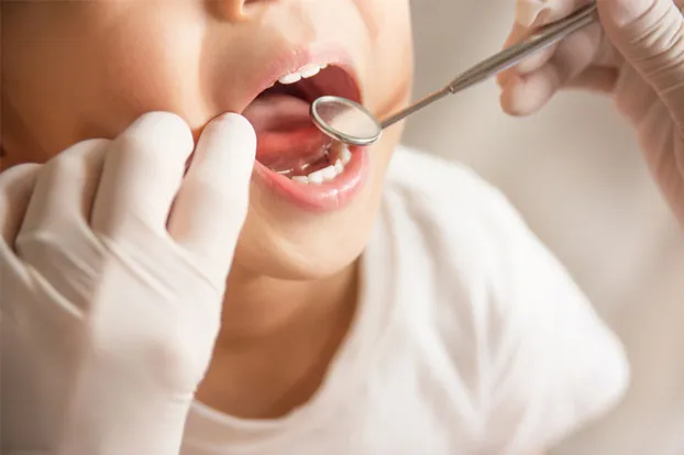 A toddler opens his mouth while the dentist performs early childhood caries treatment.
