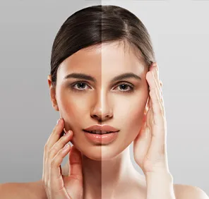 Salon in Jubilee Hills for detan - woman's face with normal and slightly fair complexion.
