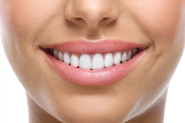 Girl with a beautiful smile - smile designing for beautiful and symmetrical teeth.
