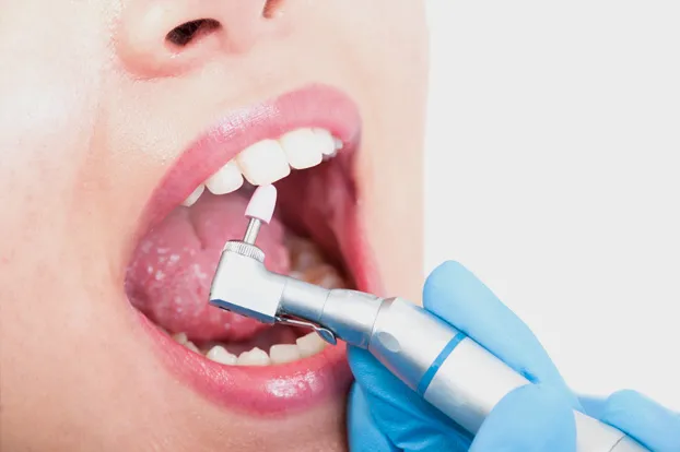 Woman getting her teeth polished
